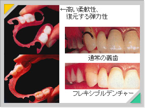 �`��(�t���L�V�u���f���`���[)